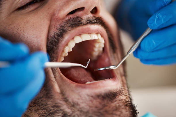 Best Pediatric Emergency Dentist in Roxboro, NC